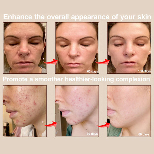 NUVVIA DERMALED™ – Professionele LED-huidverzorging voor thuis